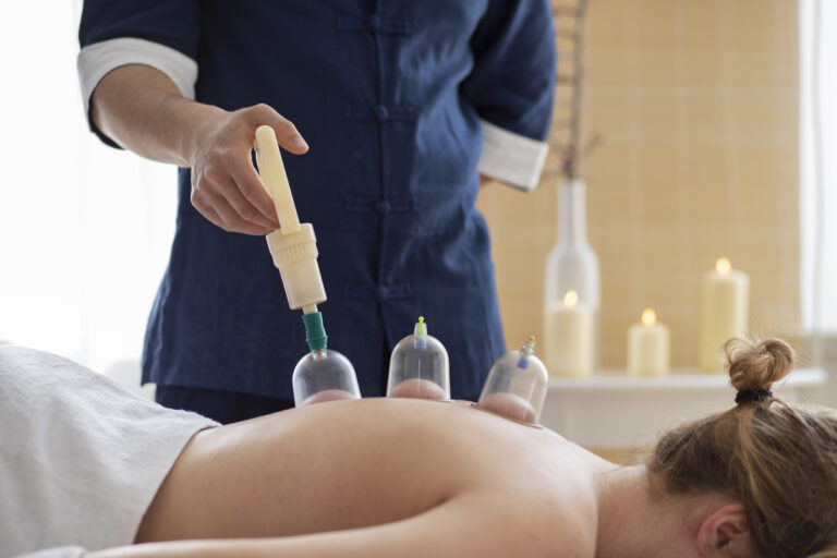 Practitioner applying cupping therapy to a patient’s back